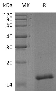 Recombinant Human TAFA4 (N-6His)
