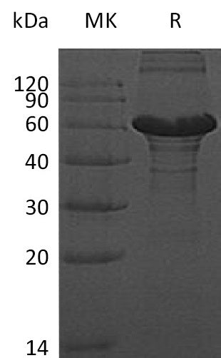 Recombinant Human ZBTB9 (C-6His)