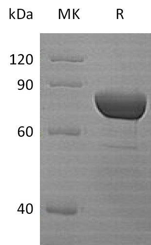 Recombinant Human DPP3 (N-6His)