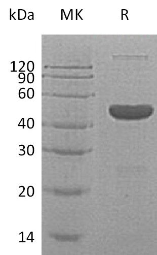 Recombinant Human GABARAP (N-6His, C-Fc)