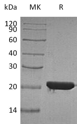 Recombinant Human FTH (N-6His)