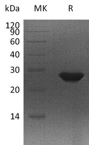 Recombinant Human MTHFS (C-6His)