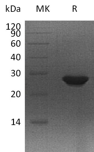 Recombinant Human MTHFS (C-6His)