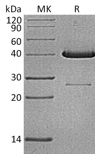 Recombinant Human UBE2D1 (N-GST)