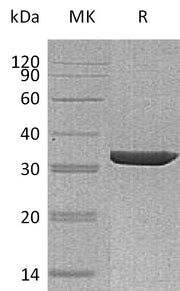 Recombinant Human ANXA3