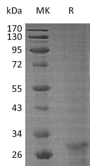 Recombinant Human KLF6
