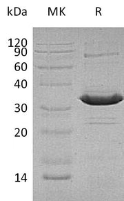 Recombinant Human ATF1 (C-6His)
