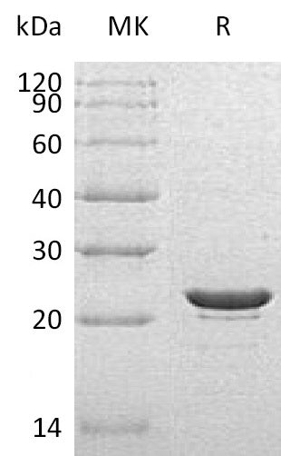 Recombinant Human HSPB8 (C-6His)