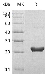 Recombinant Human RPS7 (C-6His)