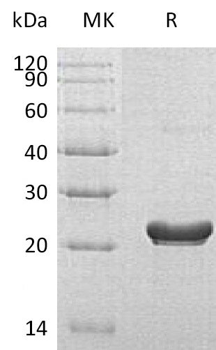 Recombinant Human RPS7 (C-6His)