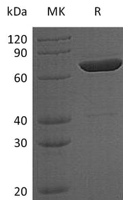 Recombinant Human SLP-76 (N-T7, C-6His)