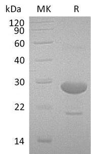 Recombinant Human IA2 (80AA&94AA, N-6His)