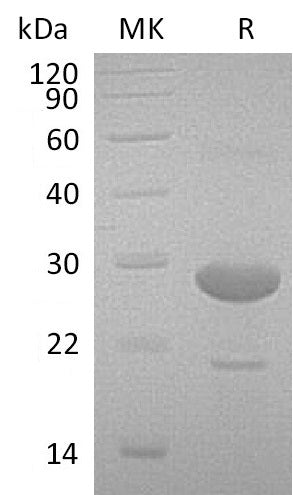 Recombinant Human IA2 (80AA&94AA, N-6His)