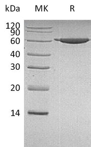 Recombinant Human PKM2 (N-6His)