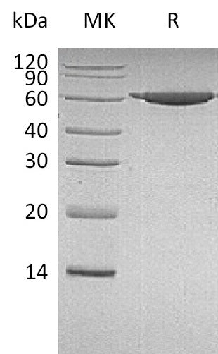 Recombinant Human PKM2 (N-6His)