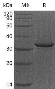 Recombinant Human Haptoglobin (N-6His)