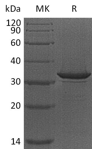 Recombinant Human Haptoglobin (N-6His)