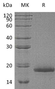 Recombinant Human TAC1 (N-6His)