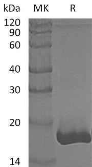 Recombinant Human GMFB (C-6His)