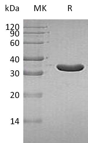 Recombinant Human IA2 (293AA, N-6His)