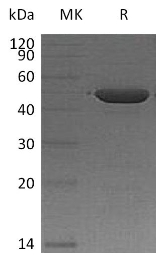 Recombinant Human IA2 (365AA, N-6His)