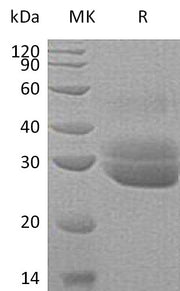 Recombinant Human EPDR1 (C-6His)