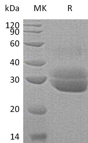Recombinant Human EPDR1 (C-6His)