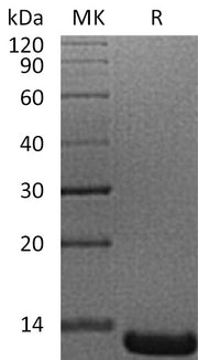 Recombinant Human ACYP1 (N-6His)