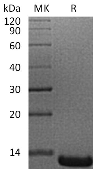Recombinant Human ACYP1 (N-6His)