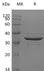 Recombinant Human ACYP2 (N-GST)