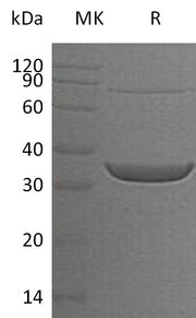 Recombinant Human ACY3 (N-6His)