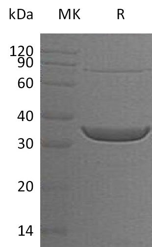 Recombinant Human ACY3 (N-6His)
