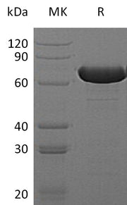 Recombinant E. coli GUSB (N-6His)