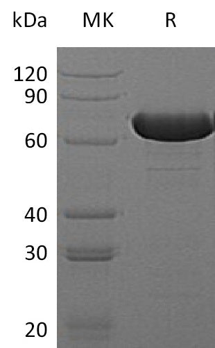 Recombinant E. coli GUSB (N-6His)
