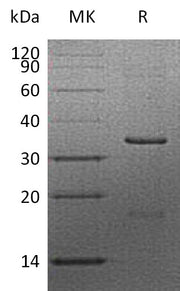 Recombinant Human CCND2 (N-6His)