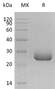 Recombinant Human PRADC1 (C-6His)