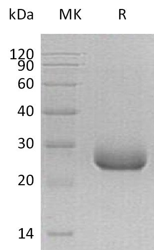 Recombinant Human PRADC1 (C-6His)