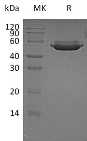 Recombinant Human CTSA (C-6His)