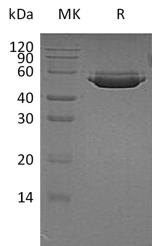 Recombinant Human CTSA (C-6His)