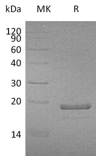 Recombinant Human MDP1 (C-6His)