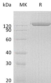 Recombinant Human pIgR (C-Fc)