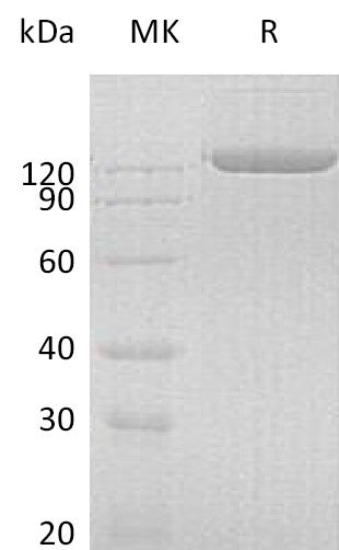 Recombinant Human pIgR (C-Fc)