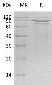 Recombinant Human MECP2 (C-6His)