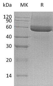 Recombinant Mouse Testican 3 (C-6His)