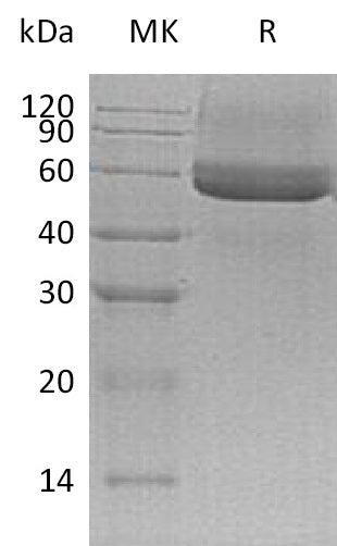 Recombinant Mouse Testican 3 (C-6His)