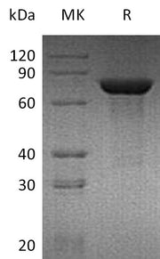 Recombinant Mouse TGM2 (C-6His)