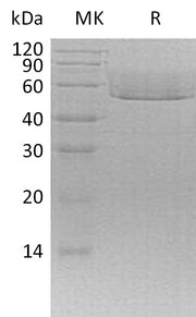 Recombinant Mouse CX3CL1 (C-6His)