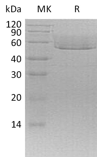 Recombinant Mouse CX3CL1 (C-6His)