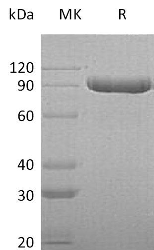 Recombinant Human ITIH3 (C-6His)