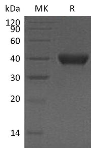 Recombinant Human RNASE T2 (C-6His)